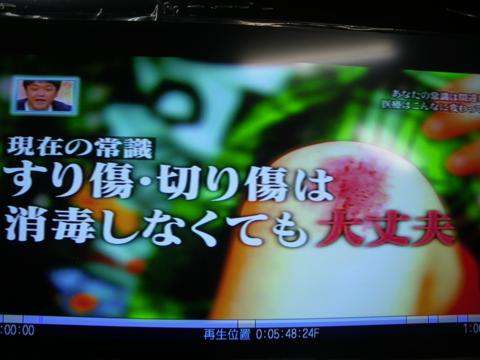 擦り傷、切り傷の治療法間違ってないですか?新常識の治療法