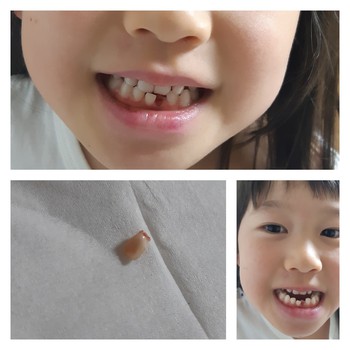 秋の味 歯歯歯歯 歯歯 秋の味 歯歯歯歯 歯歯