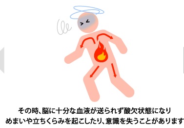 海の上ではヘタレでありたい ~熱中症、トイレリスク~ 海の上ではヘタレでありたい ~熱中症、トイレリスク~