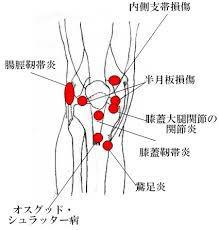 壊れた（泣）